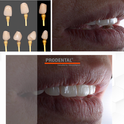 PRODENTAL Barrio Norte