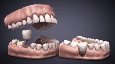 Imagen Dental Urkupiña