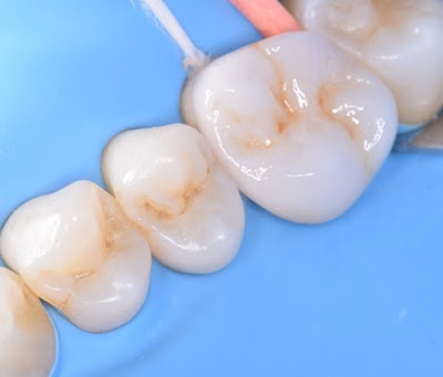 Enamel Odontología Estética