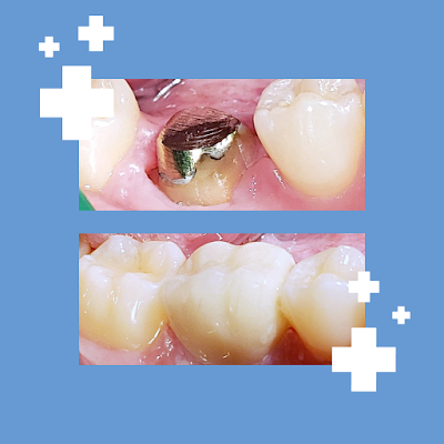 Croim Rehabilitacion Oral e Implantes (Cabildo)