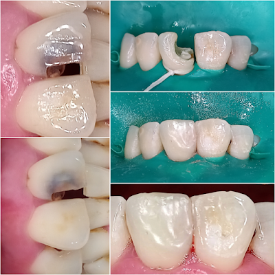 odontologia versalles