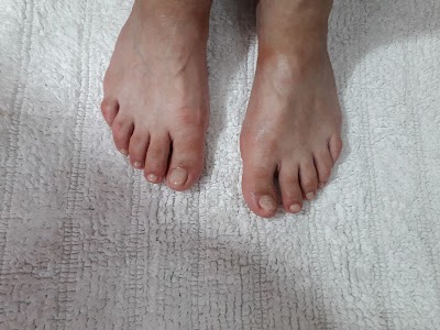 PEDICURA PROFESIONAL VICTORIA