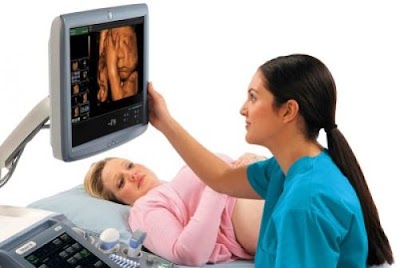 Color Doppler ultrasound