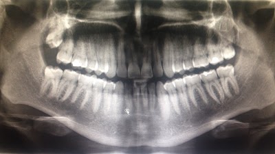 Radiología Odontológica Digital