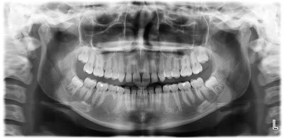 Radiografías Panorámicas R.O.S