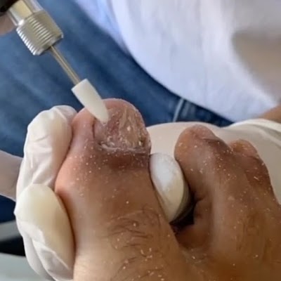 Tecnico en Pedicuria clinica