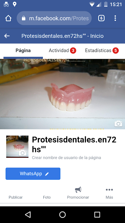 Prótesis dentales