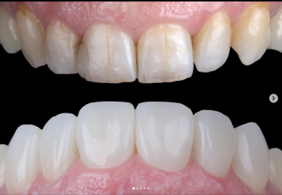 Smile Desing Odontología Estética Especializada DR RAO GONZALO