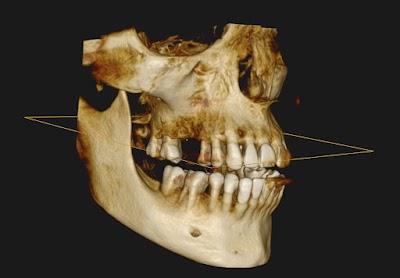 Diagnostico Odontologico MG