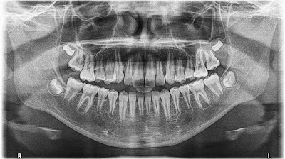 IDO3D Imagen digital Odontológica