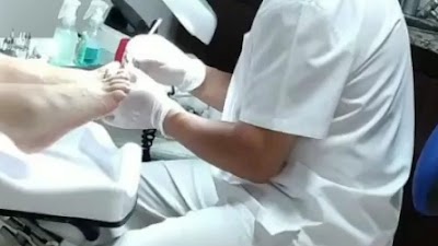 Tecnico en pedicuria clinica